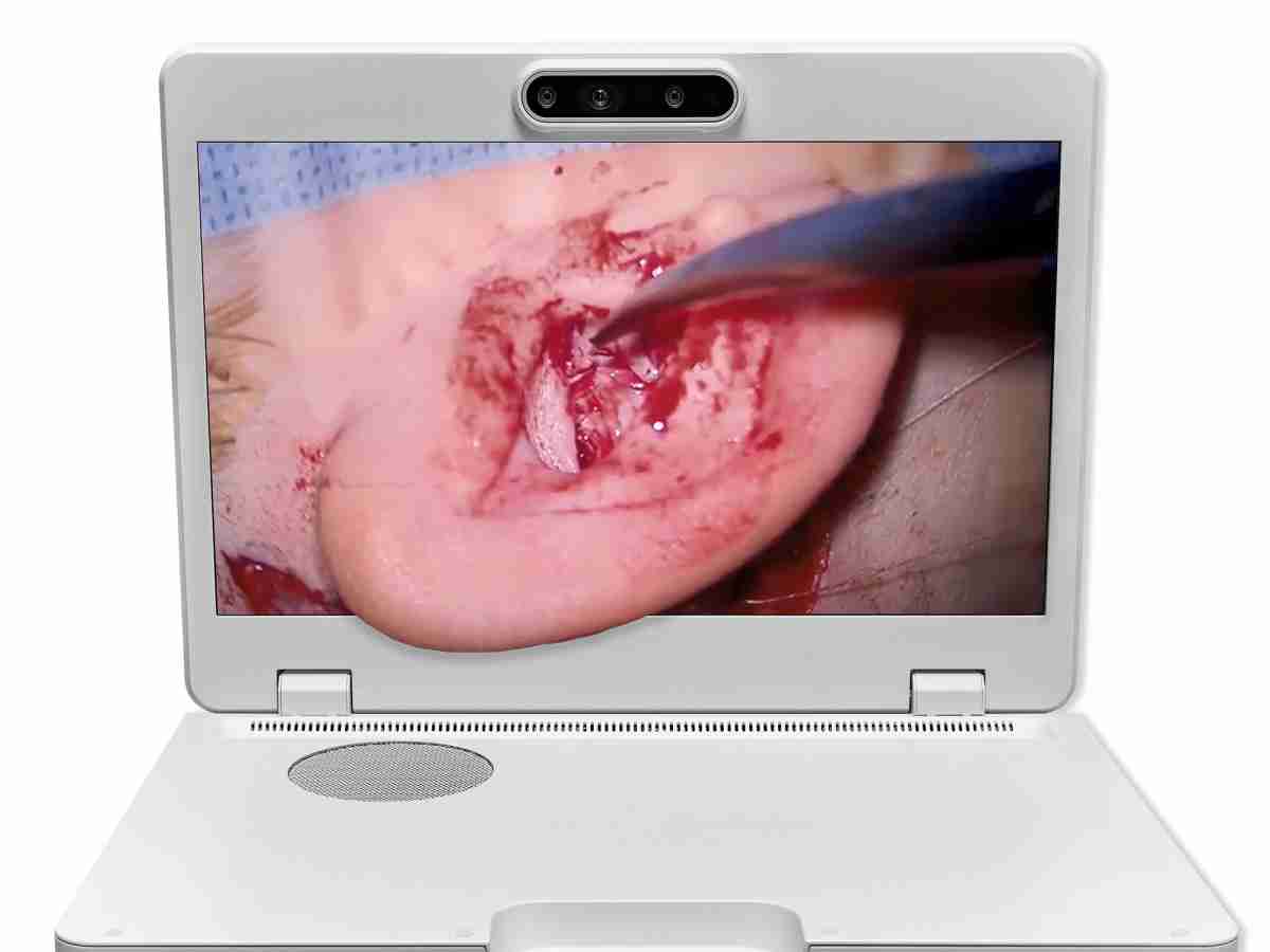 达擎之＂Heads-up 3D显微手术显示系统＂，，整合4K裸眼3D显示及眼球追踪系统，，，，具备快速追踪人眼移动位置功能，，，，减轻医师长时间维持固定姿势的负担，，，让医师能有更宽广清晰的3D立体视野及更舒适的姿势来执行手术。。。